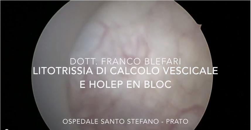 Dott. Franco Blefari Primario della U.O Urologia ASL4 Prato